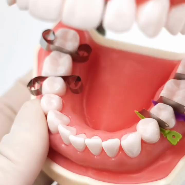 Dental Matrix Keil Wachen Abschnitts Baffle Typ Matrice Zähne Interproximal Keil Messer Mit Schutz Stahl Matrix Zahnmedizin