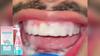 Oralhoe Niacinamide Toothpaste Gentle Fresh Clean Tartar Stain Odor Care Dental Care Toothpaste