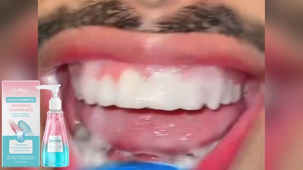 Oralhoe Niacinamide Toothpaste Gentle Fresh Clean Tartar Stain Odor Care Dental Care Toothpaste