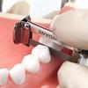 Dental Orthodontic Interproximal Enamel Reduction Treatment Polystrips Cutting off strips Polishing Tool Material