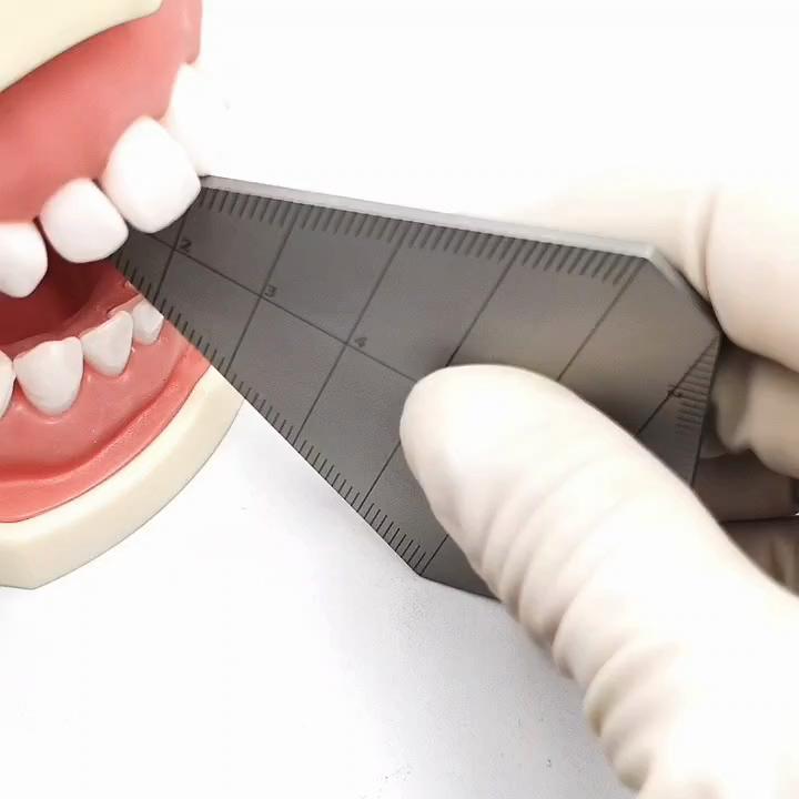 Dantų sąkandžio matuoklis, burnos kamščio atidarymo talpos matavimo liniuotė Dantų implantų matuoklis Kaulų apkabos Odontologo įrankiai