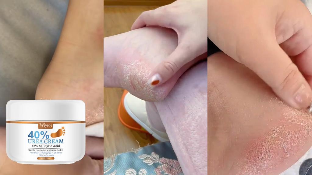 Wiyun Foot Moisturizing Cream Hydrating, Lightweight, Moisturizing, Quick-Absorbing, Nourishing Daily Care Cream for Dry Skin 30g