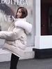 Winter Women's Fashionable Versatile Shiny Loose Warm Coat