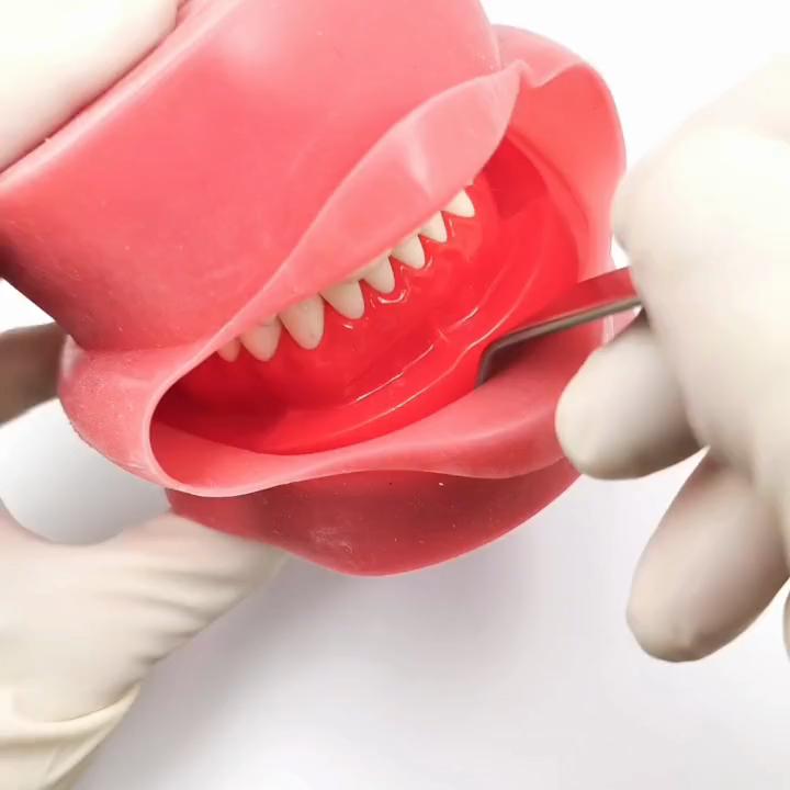 Écarteur dentaire universel Écarteur de joues et de lèvres Écarteur de vestibule d'implant Outils de rétraction photographique Écarteur chirurgical