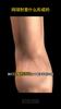 Tennis elbow special plaster humerus lateral epicondylitis gel arm elbow joint pain strain official genuine import patch