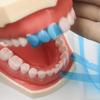 15ks/50ks Dentální tvarovaná přední matrice Modrá Transparentní přední polyesterový pásek Tloušťka 0,05 mm Dentální materiály