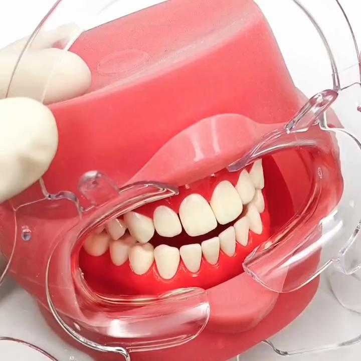 Dental Orthodontic C Type Tooth Intraoral Lip Cheek Retractor Mouth Opener Orthodontic Material Teeth Whitening Tool