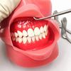 Dentálny retraktor Kocher-Langenbeck Retraktor Chirurgia lícneho tkaniva Retraktor Chirurgické nástroje z nehrdzavejúcej ocele