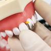 Dental Anterior Matris Sistemi Kama Matris Bantları İnterdental Kamalar Diş Hekimliği Malzemeleri Oral Materyaller