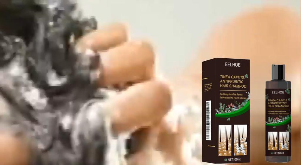EELHOE Anti-Dandruff Itch Relief Shampoo Anti-Fall Refreshing Oil Control Hair Care Anti-Dandruff Itch Relief Shampoo