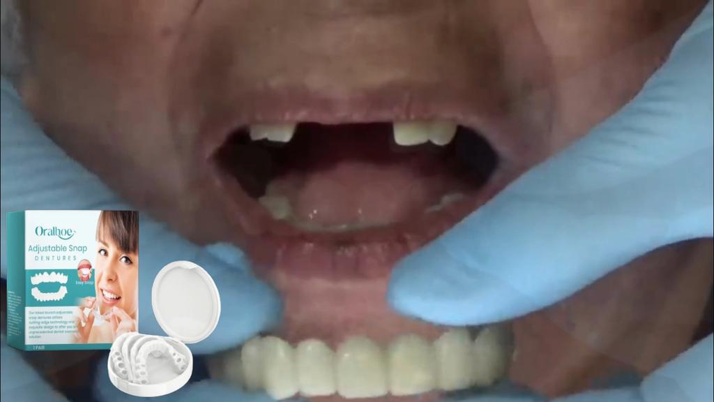 Oralhoe Регулируемые защелкивающиеся зубные протезы Удобные регулируемые зубные протезы подходят для жевания зубов Power Fit