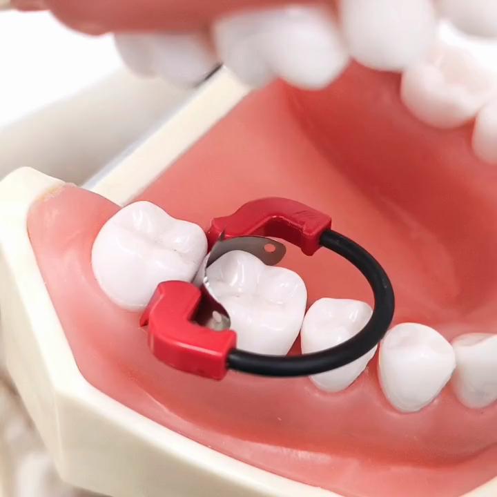 1 Pc or 2pcs or 3 Pcs Dental Contoured Matrices Clip Ring with PEEK Matrix System Set Matrix Bands Wedge Flexible NITI Materials