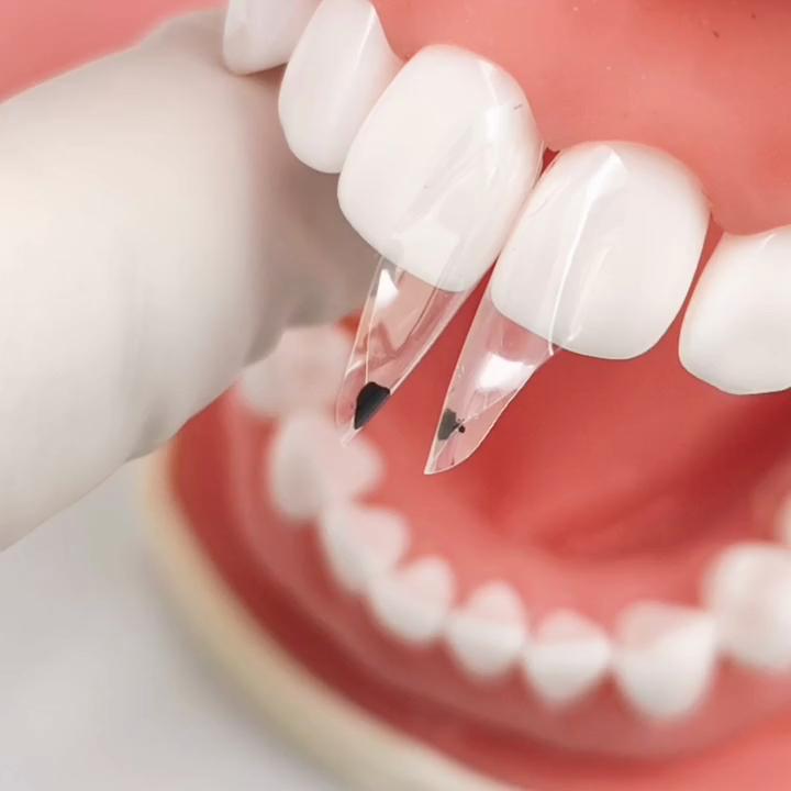 1 paket (150 adet/paket) Dental Clear Matrix BT Şeffaf Matrisler Ön PosteriorFit Bioclear Dişler Molar Bow Sınıf Restorasyonu Siyah Üçgen