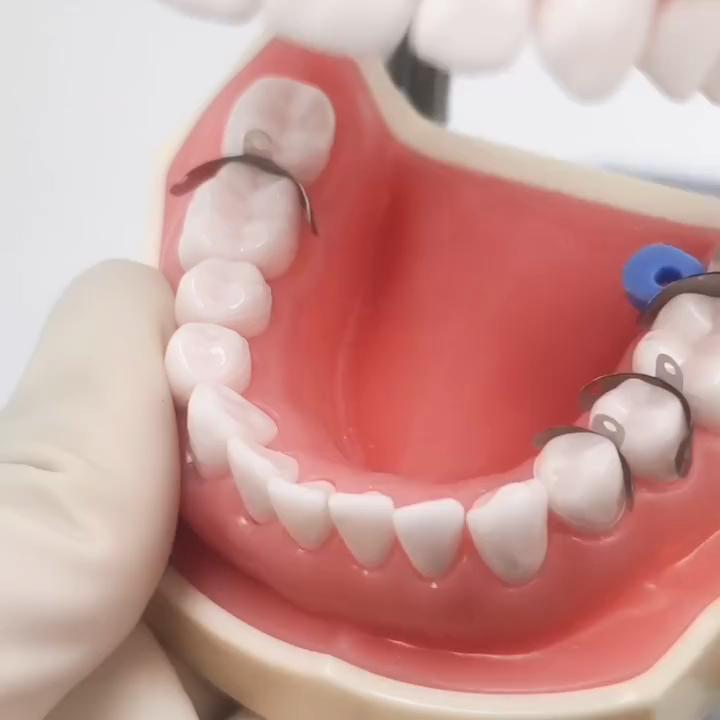 80pcs New Dental Sectional Contoured Metal Matrices Matrix Set Matrix Bands Rubber Wedges with Add-on Wedges Dentist Materials