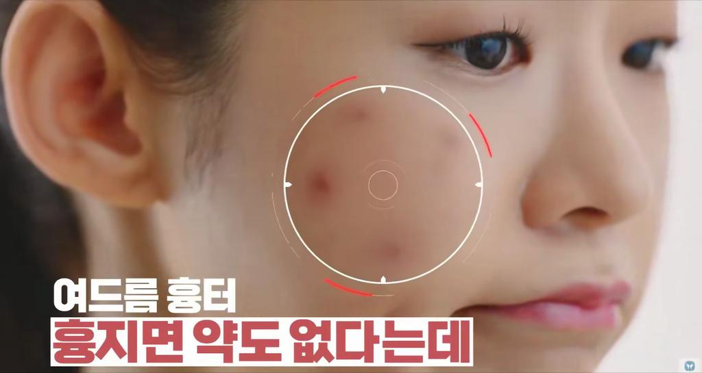 [Dong-A Pharmaceutical] Noscarna Gel 20g