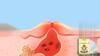 Wiieey Star Pimple Patch Fade Down Pimple Pimple Marks Clean Face Closed Acne Portable Cartoon Pimple Patch
