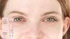 Viareline softening Eye Care Cream gently moisturizes the skin around the eyes, a daily basic eye care product 30g