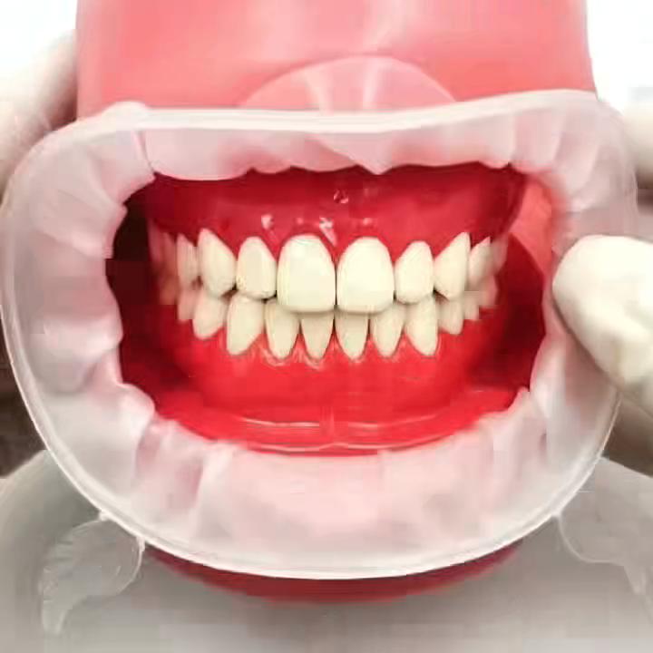 Dental Mouth Spreaders 3D Dental O Shape Cheek Retractors Lips Protection Mouth Openers Regular Adult and Child Models