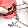 Upgrade Dental Orthodontic T Shape Vestibulum Retractor Lip Cheek Retractor Mouth Gag Opener Mouth Retractor Double Ends
