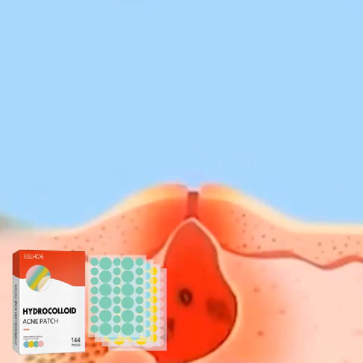 EELHOE Colorful Acne Patch is mild and non-irritating to lighten acne pimples and improve acne-prone skin.
