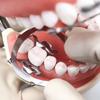 Dental Clip Rubber Dam Barrier Clamps Clip with Bracket Holder Stainless Steel