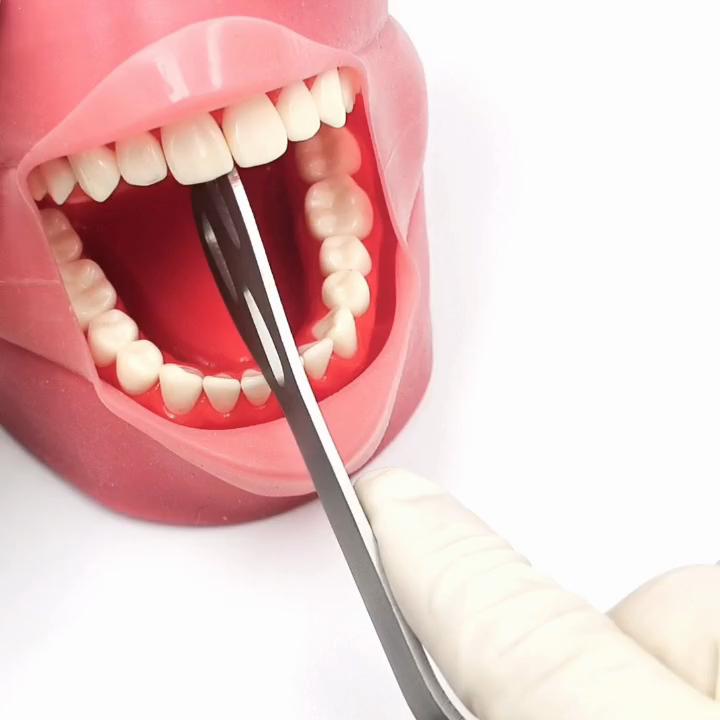 1 Piece Dental Wider Retractor Lingual Isolation Retractor Mouth Retractor Dental Retractors Oral Mouth Opener Mouth Gag